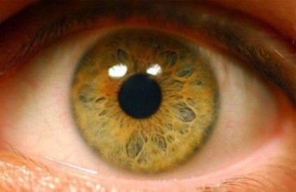 Detașarea retinei - cauze, simptome și tratament
