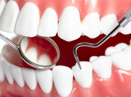 Parodonția - tratamentul parodontitei și a bolii gingiilor