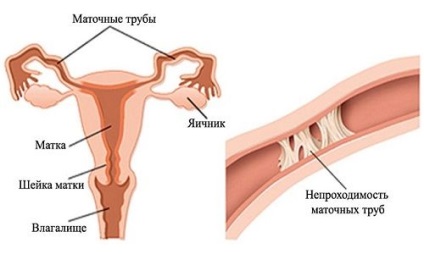 Perturbarea tuburilor uterine ale clinicii andrologice pe stațiile de metrou Kursk și Chkalovskaya