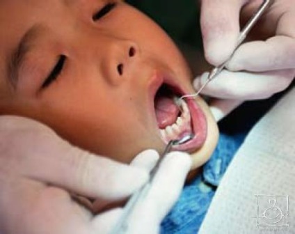 De ce copiii au dinți inegali