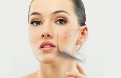 După masaj facial, acnee - puteți evita acest lucru