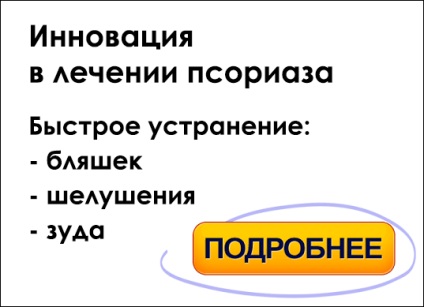 Причини псоріазу від чого з'являється псоріаз, причини виникнення