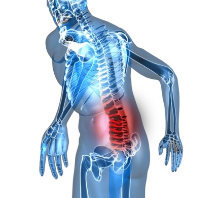 Epidurita spinală purulentă (pahimenigită externă) Descriere, diagnostic, tratament