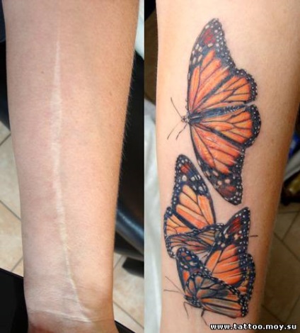 Tatuaj pe cicatrici - tatuaje care ascund cicatrici