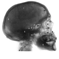 Topografia craniului