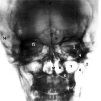 Topografia craniului