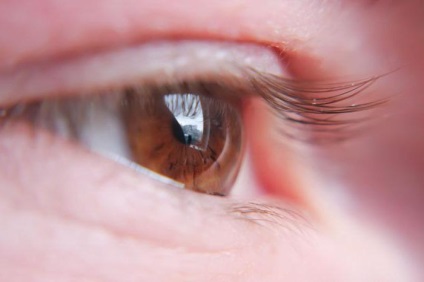 Lentilele Toric - cum să purtați lentile pentru corectarea astigmatismului - viața mea