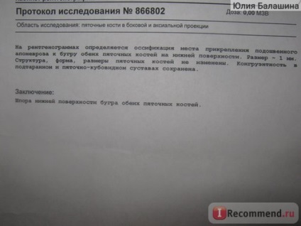 Ударно-хвильова терапія - «ходіння по муках закінчилися докладна схема лікування (фото)», відгуки