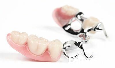 Види протезування зубів ціна і фото