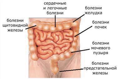 Захворювання пов'язані з серцем - лікування серця