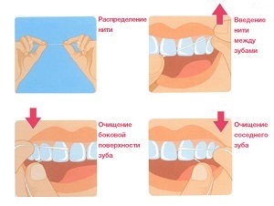 Зубна нитка як правильно використовувати для чищення