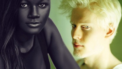 5 Людей з дивним кольором шкіри, якими не можливо не милуватися