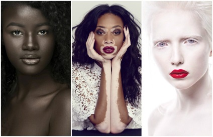 5 Людей з дивним кольором шкіри, якими не можливо не милуватися