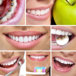 Адгезивная реставрація зубів - відновлення зубів в москві