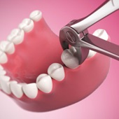 Акції клініки сучасної стоматології