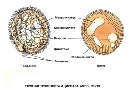 Balantidiasis (Balantidium coli, bél Balantidium) emberben a tünetek, diagnózis, kezelés,