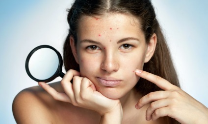 Білі прищі на обличчі причини, методи лікування і рецепти масок