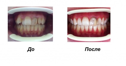 Nadrágtartók - Dental Dentalux g