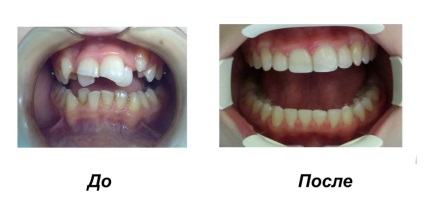 Брекети - стоматологія Денталюкс г
