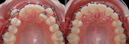 Nadrágtartók - Dental Dentalux g