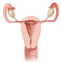 Ce malnutriție uterină periculoasă și cum să o identificați și să o tratați