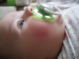 Чим промивати очі новонародженому розвиток дитини
