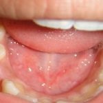 Ce este durere în gura unui copil și cum să-l tratați în mod corespunzător