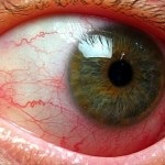 Diabetikus angiopátia retinális szemsérülés az ereket és a kapillárisok, a betegség kezelésében