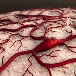 Diabetikus angiopátia retinális szemsérülés az ereket és a kapillárisok, a betegség kezelésében
