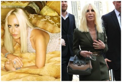 Donatella Versace, ca steaua privită înainte și după operațiunile din plastic