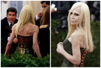 Donatella Versace, ca steaua privită înainte și după operațiunile din plastic