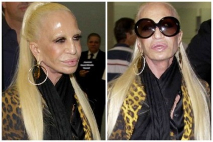 Donatella Versace, ca steaua privită înainte și după operațiunile din plastic