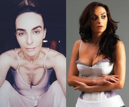 Катерина Варнава фото до і після операції