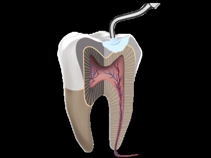 Elite club dentar