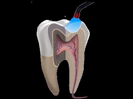 Elite club dentar