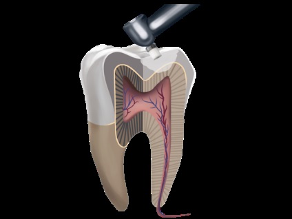 Elite dental club