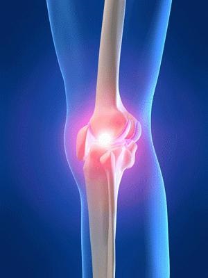 Якщо ви відчуваєте біль в коліні під час фізичних навантажень - ця стаття для вас