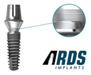 Implants ards - prețuri, recenzii