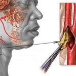 Măsurarea pulsului arterial pe artera radială