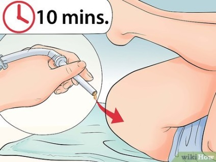 Cum să faci o clismă