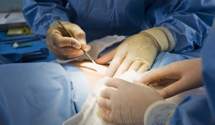 Cum se trateaza ficatul dupa o interventie chirurgicala