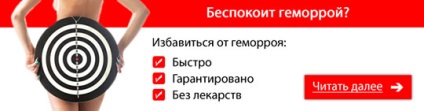 Як лікується геморой чим краще лікувати, комплексне лікування, гірудотерапія, лікування геморою