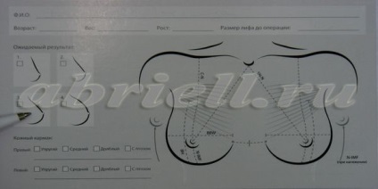 Cum de a alege sistemul de logica corpul implanturilor, abryll