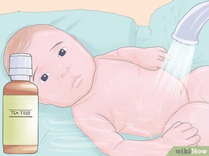 Cum se vindeca eczema la un copil cu remedii naturale