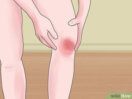 Cum se poate recupera de la chirurgia genunchiului artroscopic