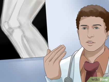 Hogyan lehet visszaállítani után artroszkópos térdműtét