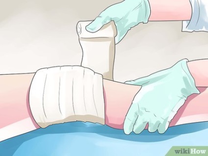 Cum se poate recupera de la chirurgia genunchiului artroscopic