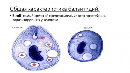 Ciclul de viață al dezvoltării parazitului intestinal al balantidiului intestinal (balantidium coli)