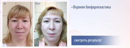 Clinica de cosmetologie si chirurgie plastica cu medici in Ivanovo si Sankt-Petersburg