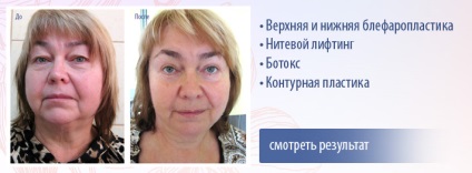 Clinica de cosmetologie si chirurgie plastica cu medici in Ivanovo si Sankt-Petersburg
